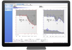 Madsen Itera II | บริษัท มารุ่งโรจน์ จำกัด | เครื่องช่วยฟัง เครื่องมือแพทย์